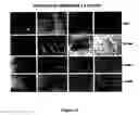 Fig. 15 - Human embryonic stem cell clones
