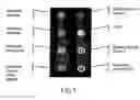 Fig. 02 - Method for seriological diagnosis and determination of immunisation status, comprising various controls