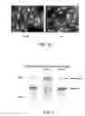 Fig. 05 - Development of influenza A antivirals