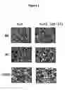 Fig. 02 - Constitutively active CXCR3 G protein-coupled chemokine receptor and modulators thereof for the treatment of inflammatory disorders