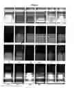 Fig. 03 - Comparative genomic hybridization