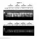 Fig. 16 - Comparative genomic hybridization