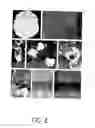 Fig. 02 - Differentiation of human embryonic stem cells to cardiomyocytes