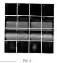 Fig. 03 - Differentiation of human embryonic stem cells to cardiomyocytes