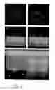 Fig. 07 - Differentiation of human embryonic stem cells to cardiomyocytes