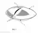 Fig. 02 - Breast prosthesis enclosure
