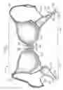 Fig. 02 - Brassiere Assembly with Different Cup Sizes