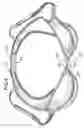 Fig. 05 - Brassiere Assembly with Different Cup Sizes