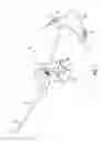Fig. 02 - Knee-stretching Device and Treatment Methods