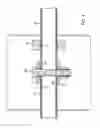 Fig. 05 - Knee-stretching Device and Treatment Methods