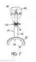 Fig. 08 - Knee-stretching Device and Treatment Methods