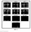 Fig. 02 - Modulating cancer cell characteristics