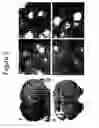 Fig. 03 - Methods and compositions for treating neurological disease
