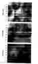 Fig. 12 - Method of treating neurodegenerative disease