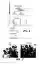 Fig. 03 - Pharmaceutical composition useful for treating chronic myeloid leukemia