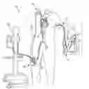 Fig. 01 - Percutaneous right ventricular assist apparatus and method