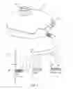 Fig. 04 - Staged implantation of ventricular assist devices