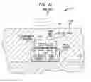 Fig. 05 - Implantable interferometer microphone