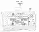 Fig. 06 - Implantable interferometer microphone