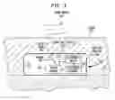 Fig. 07 - Implantable interferometer microphone