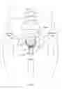 Fig. 04 - Apparatus and method for suspending a uterus