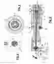 Fig. 03 - Method and instrument for the geometrical evaluation of lesions affecting tissues or internal organs