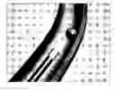 Fig. 01 - System and method for endoscopic measurement and mapping of internal organs, tumors and other objects