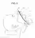 Fig. 04 - Oxygenating laryngoscope