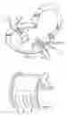 Fig. 05 - Retractor blade and bridge system