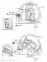 Fig. 03 - Head-stabilized medical apparatus, system and methodology