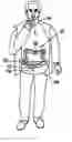 Fig. 01 - Intra-lumen polyp detection