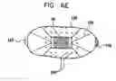 Fig. 10 - Intra-lumen polyp detection
