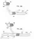 Fig. 12 - Intra-lumen polyp detection
