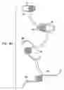Fig. 13 - Intra-lumen polyp detection