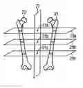 Fig. 01 - Method and apparatus for evaluating a 3D image of a laterally-symmetric organ system