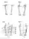 Fig. 03 - Method and apparatus for evaluating a 3D image of a laterally-symmetric organ system
