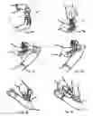 Fig. 04 - Practitioner-mounted micro vein enhancer