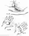 Fig. 06 - Practitioner-mounted micro vein enhancer