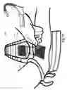 Fig. 12 - Micro vein enhancer