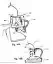 Fig. 16 - Micro vein enhancer