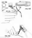 Fig. 27 - Micro vein enhancer