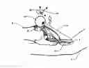 Fig. 01 - Micro vein enhancer