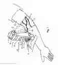 Fig. 02 - Micro vein enhancer