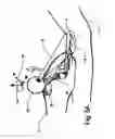 Fig. 07 - Micro vein enhancer