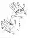 Fig. 08 - Micro vein enhancer
