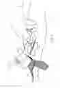 Fig. 10 - Micro vein enhancer