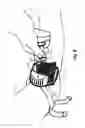 Fig. 11 - Micro vein enhancer