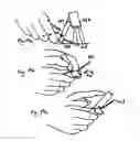Fig. 26 - Micro vein enhancer