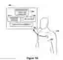 Fig. 04 - Assessing autonomic activity using baroreflex analysis
