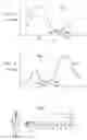 Fig. 04 - Method of and apparatus for detecting diseased tissue by sensing two bands of infrared radiation